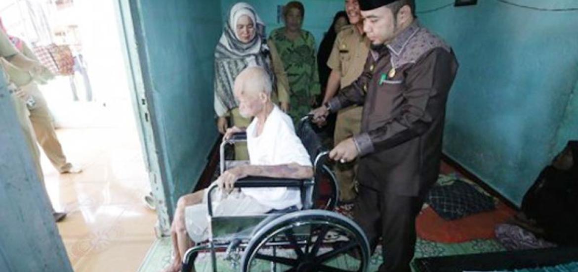 Walikota Bengkulu Helmi Hasan memberikan 2 unit kursi roda kepada warga di Kelurahan Kebun Beler dan Kelurahan Anggut