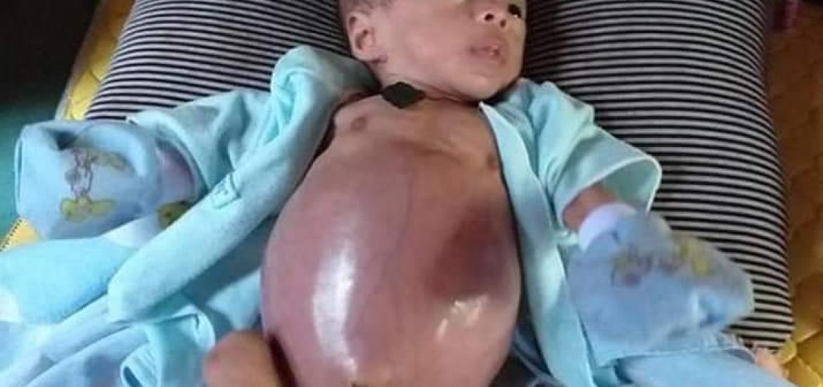Ilham,  Bayi yang membutuhkan peetolongan