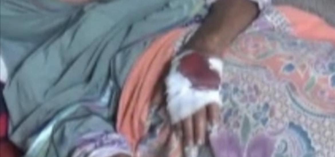 Korban digigit buaya