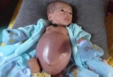 Ilham,  Bayi yang membutuhkan peetolongan